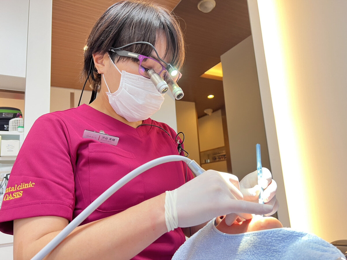 歯石除去の重要性と効果的なタイミング