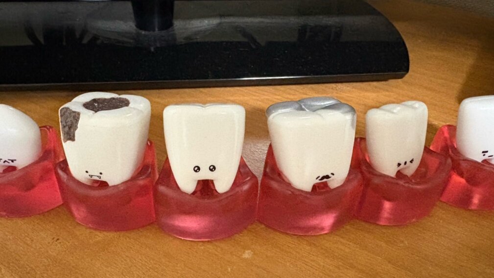 こんにち歯　その2